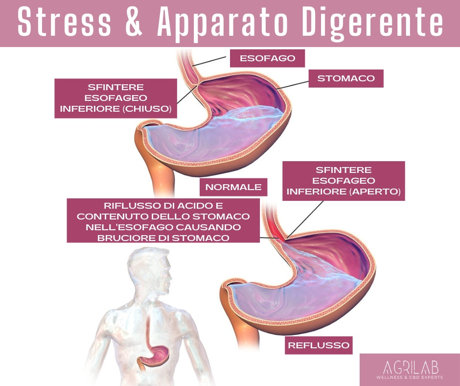 come lo stress può causare problemi all'apparato digerente