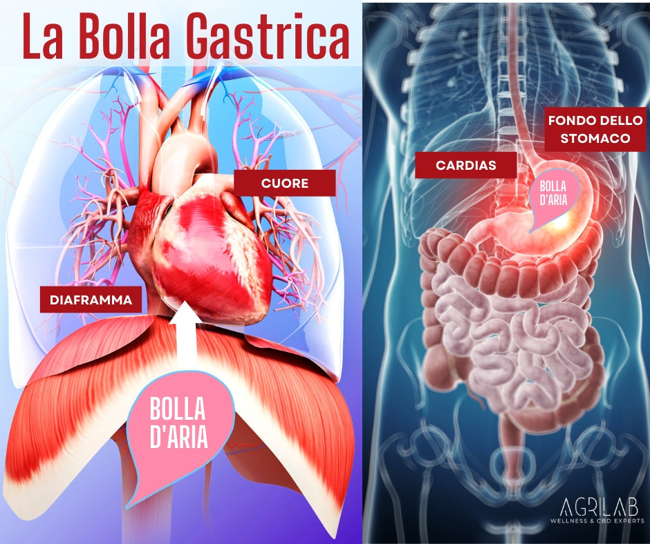 Bolla gastrica rimedi naturali
