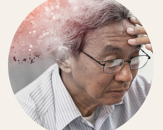 cbd isolato e cura dell'alzheimer