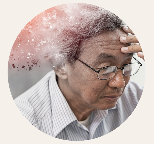 cbd isolato e cura dell'alzheimer