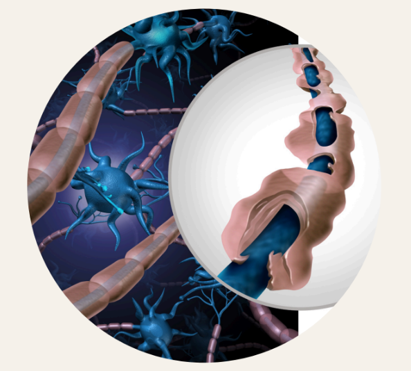 rappresentazione connessioni neuronali agrilab cbd per sclerosi multipla 