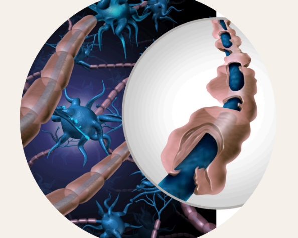 rappresentazione connessioni neuronali agrilab cbd per sclerosi multipla 